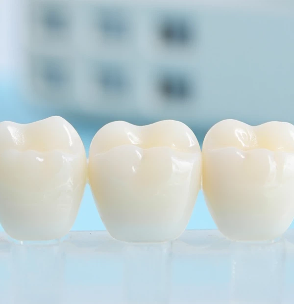 Dental Crowns in Arlington VA