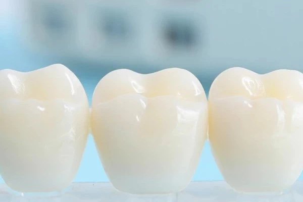 Dental Crowns